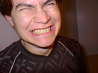 party_knife_dent_jaunes