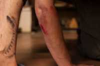 elz_fleshwound