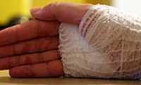 wounded_hand