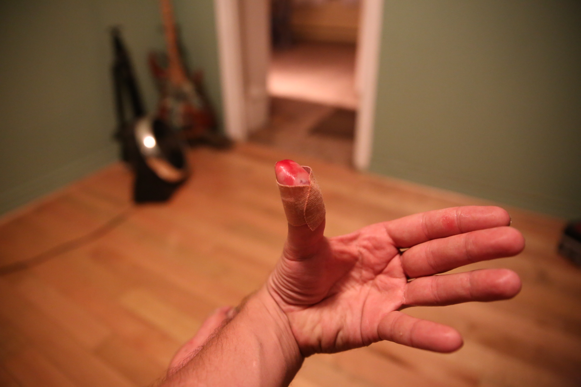 dog_bite
