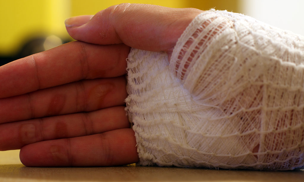 wounded_hand