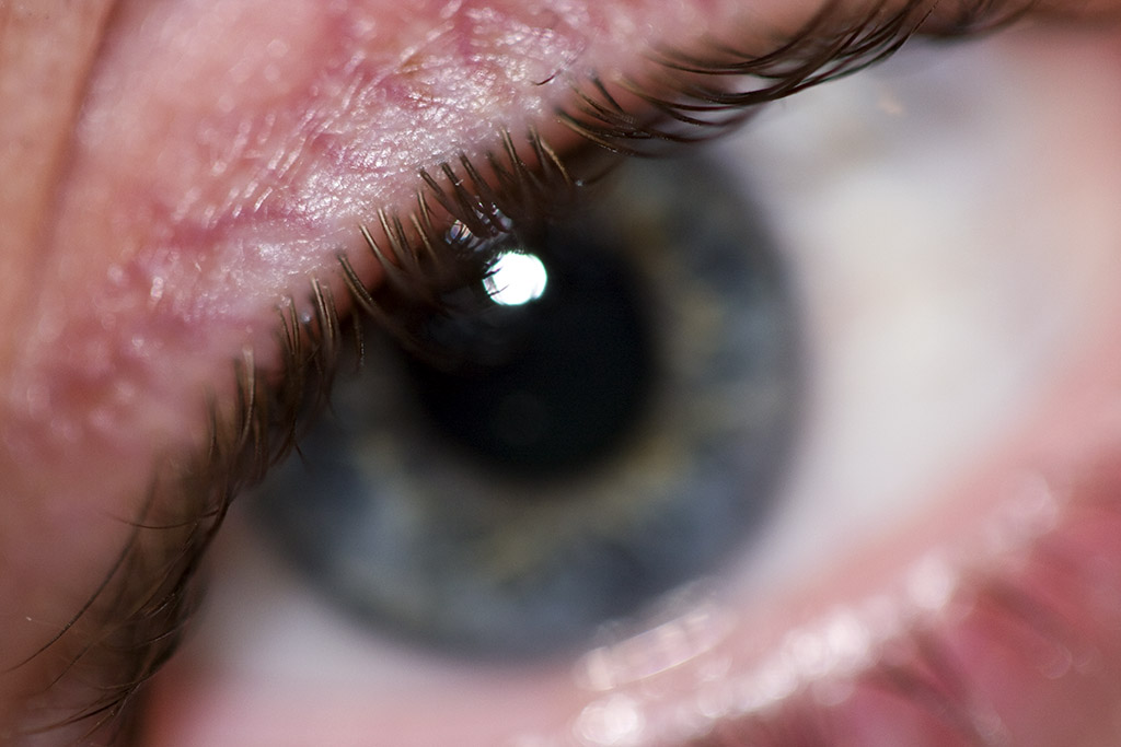cils