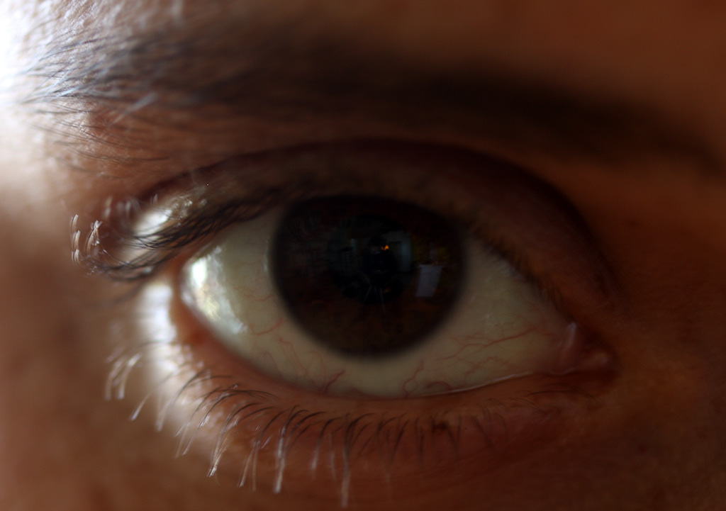 vero_eye